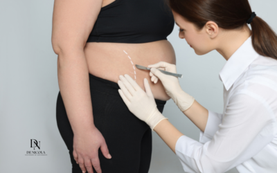 Cobertura da Cirurgia Bariátrica